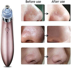 4-in-1 Multifunctional Beauty Pore Vacuum Frendzys